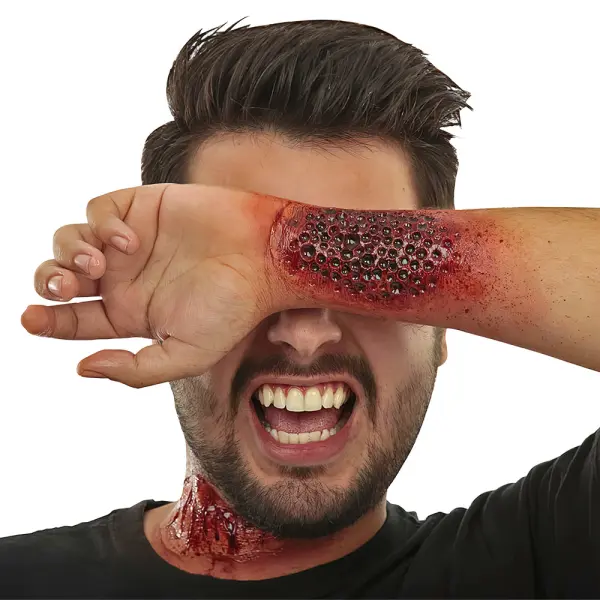 Trypofobi Latexsår